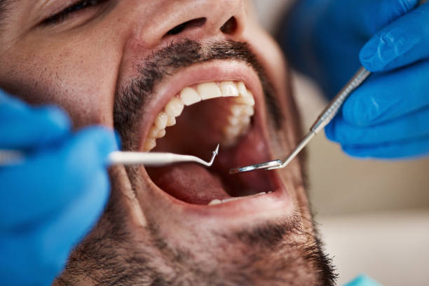Best Affordable Emergency Dental Care  in Laughlin Af, TX