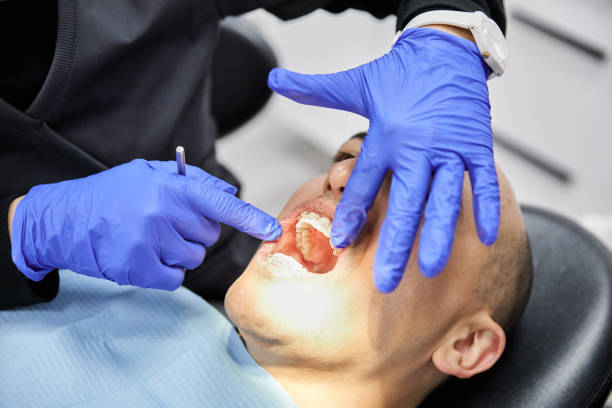 Best Dentist for Tooth Abscess  in Laughlin Af, TX